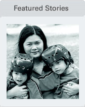 Surgi-Max專利技術(shù)實現(xiàn)連體嬰兒成功分離